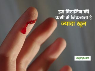 मामूली सा कट लगने पर बहने लगे ज्यादा खून तो डायबिटीज नहीं शरीर में हो गई है इस विटामिन की कमी, जानें स्त्रोत 