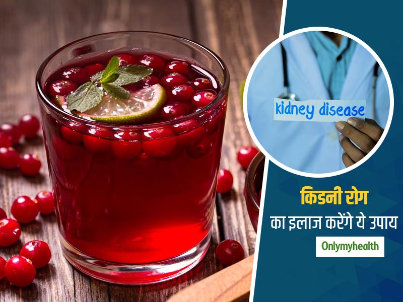किडनी रोग का इलाज करने के लिए अपनाएं ये उपाय, कुछ ही दिनों में दिखने लगेगा असर