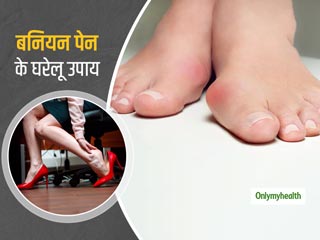 हाई हील्‍स का फैशन बन सकता है बनियन (Bunions) का कारण, जानें बनियन के दर्द को कम करने के 5 बेहतरीन उपाय 