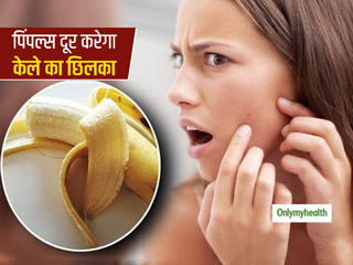 Banana Peel For Acne: मुंहासों से छुटकारा दिलाएगा केले का छिलका, घर पर बनाएं केले के छिलके से ये 3 फेस पैक 