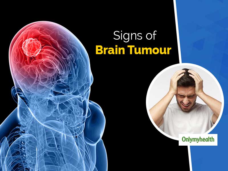 World Brain Tumour Day 2021: Know The Warning Signs Signalling Tumor Growth