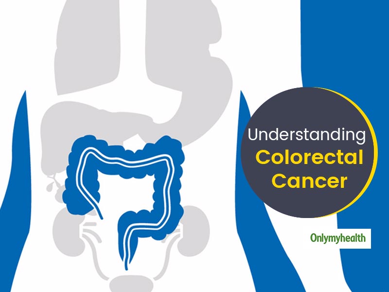 Colorectal Cancer Awareness Month 2021: Symptoms, Causes And Treatment Of Colon Cancer