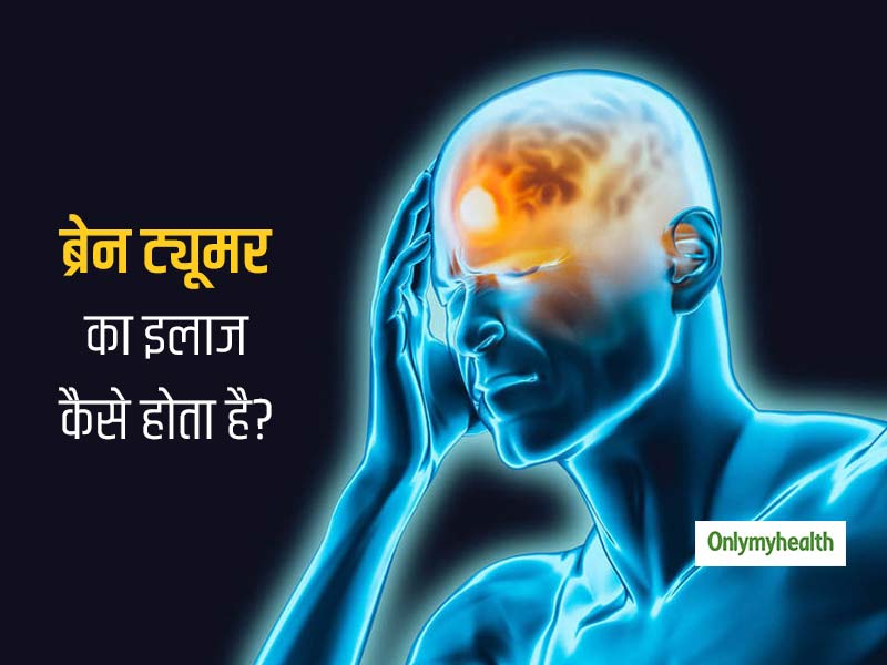 World Brain Tumor Day: ब्रेन ट्यूमर होने पर कैसे बच सकती है मरीज की जान? जानें इसके लक्षण और इलाज के तरीके