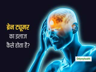 World Brain Tumor Day: ब्रेन ट्यूमर होने पर कैसे बच सकती है मरीज की जान? जानें इसके लक्षण और इलाज के तरीके