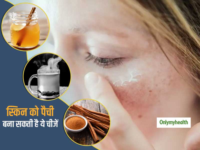 Skin Care Tips: चेहरे पर न लगाएं ये 4 प्राकृतिक चीजें, स्किन हो जाएगी पैची और डार्क