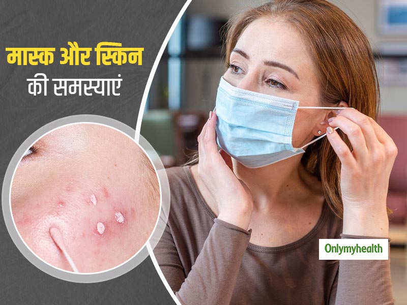 मास्क पहनने से हो रही है आपको स्किन से जुड़ी ये परेशानियां? इन 4 प्राकृतिक तरीकों से पाएं छुटकारा 