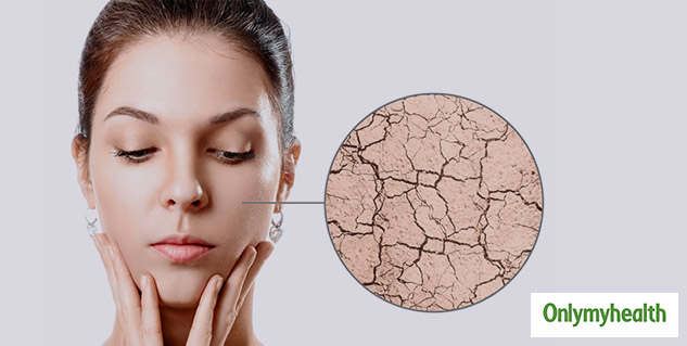 insidedryskin