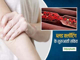 ब्लड क्लॉटिंग के शुरुआती संकेतों को न करें नजरअंदाज, जानें इसके लक्षणों को पहचानने का तरीका