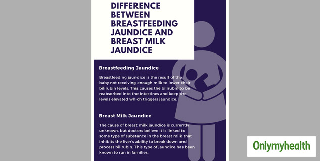 What Is Breast Milk Jaundice? Know Causes, Symptoms and Prevention Tips