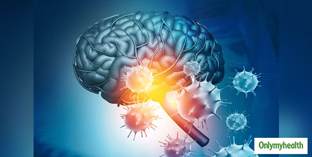 Treatment Of Epilepsy 