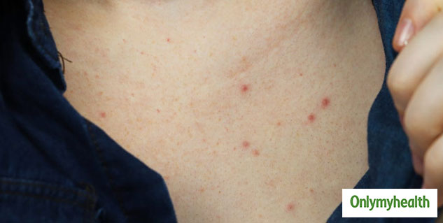 insidecausesofchestacne