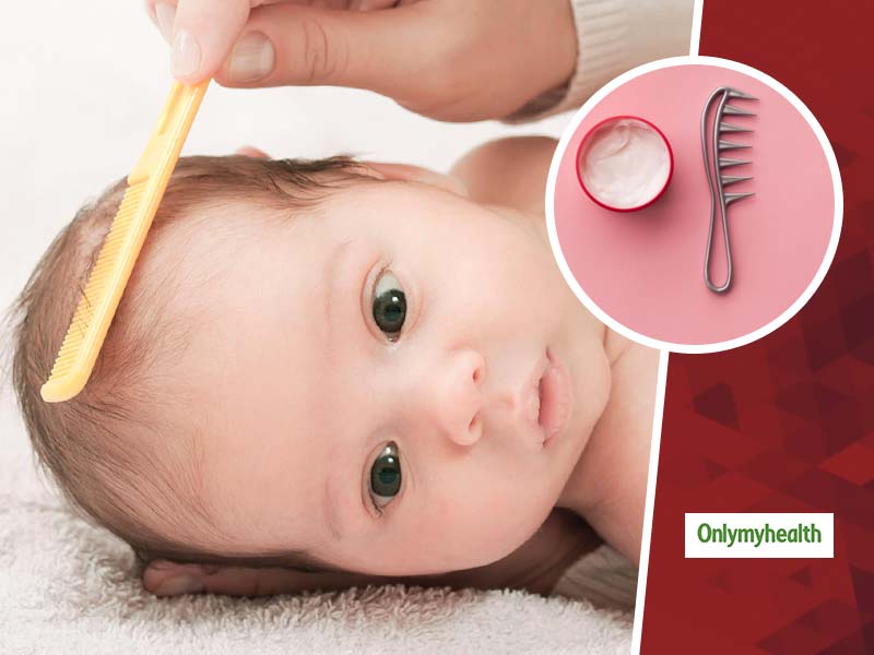 Baby 2024 dandruff treatment