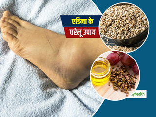 Remedies For Edema: शरीर के विभिन्‍न अंगों में होने वाली सूजन हो सकती है एडिमा, इन 4 घरेलू उपायों से पाएं राहत
