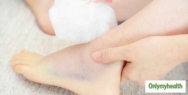 Feet Swelling Remedies