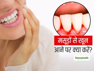 Bleeding Gums: मसूड़ों से आने वाले खून को रोकने और दांतों को मजबूत बनाने में मदद करते हैं ये 5 घरेलू उपाय
