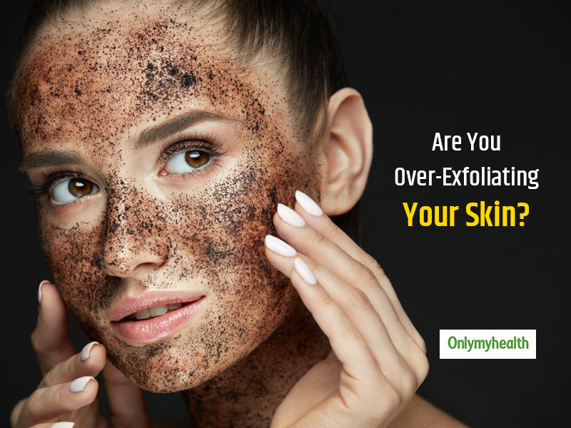 Are You Exfoliating Your Skin More Than What’s Required? Know Signs of Over-Exfoliated Skin