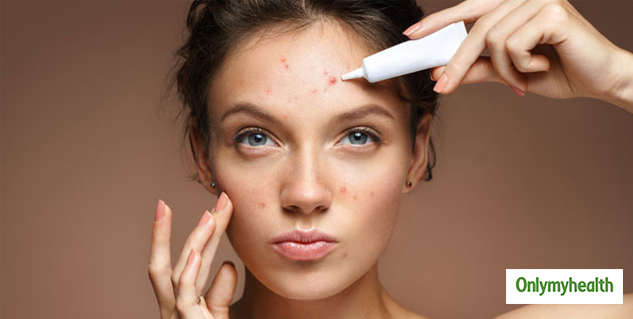 Skin Allergies