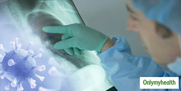 Coronavirus Cause lung problem after recovery
