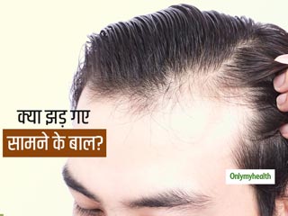 क्या सामने के बाल झड़ने से आपकी खोपड़ी भी नजर आने लगी खाली? जानें सामने के बाल दोबारा उगाने के तरीके