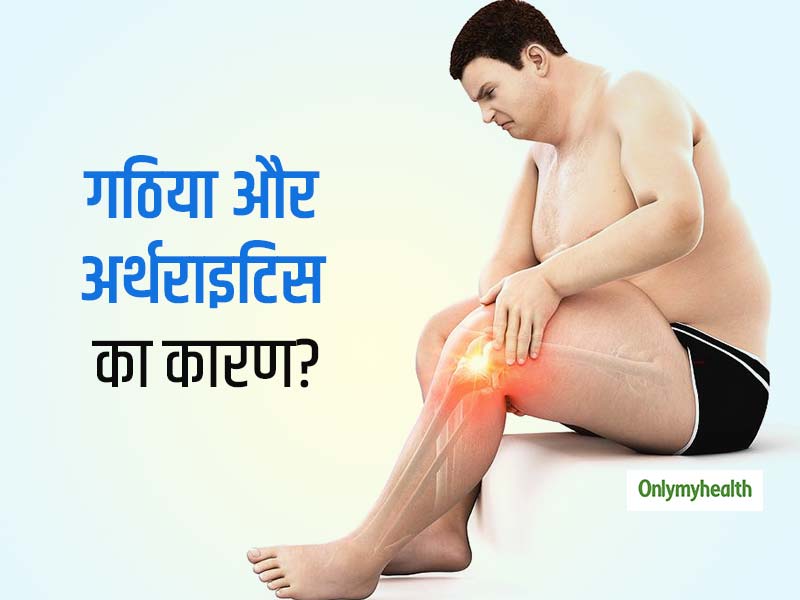 गठिया और अर्थराइटिस से परेशान हैं तो मोटापा हो सकता है कारण, शरीर में जमा फैट बढ़ाता है यूरिक एसिड