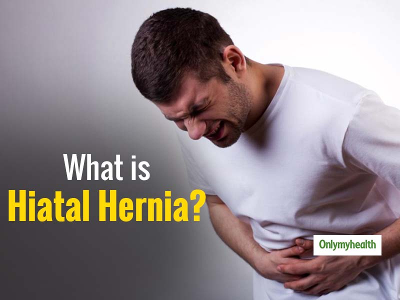 Hiatal Hernia In Men: Know The Symptoms and Preventive Measures