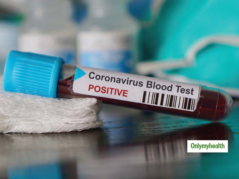Confirmed! First Positive Case of COVID-19 Coronavirus In Delhi