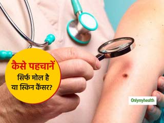 Mole Or Melanoma:  स्किन पर दिखने वाला तिल या मोल कहीं कैंसर का संकेत तो नहीं? इन 6 तरीकों से लगाएं पता