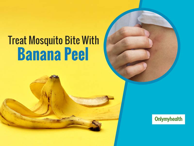 Banana Peel For Mosquito Bites: 3 Ways To Use The Discarded Peel 