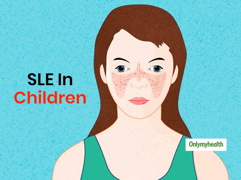 Systemic Lupus Erythematosus In Kids: Understanding SLE And Its Symptoms