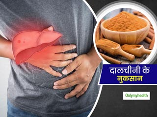 दालचीनी का ज्यादा सेवन आपके स्वास्थ्य के लिए कैसे हो सकता है नुकसानदेह, जानें 3 कारण 