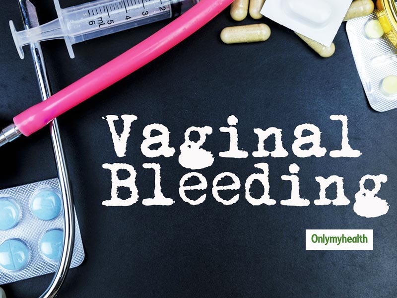 Causes of abnormal bleeding between online periods