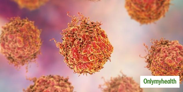 breast cancer cells