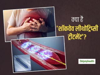 आर्टरी में ब्लॉकेज की समस्या को दूर कर सकता है 'शॉकवेव लीथोट्रिप्सी ट्रीटमेंट', जानें क्या है ये और इसके फायदे