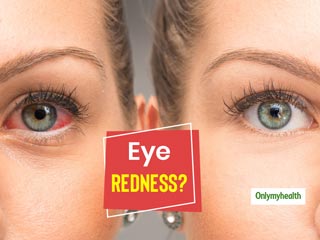 Red Eyes? Here Are The 5 Reasons Behind It 
