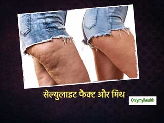 Myths and Facts Body Cellulite: जानें क्‍या है बॉडी सेल्युलाइट? और इससे जुड़े सच और क्या झूठ? 