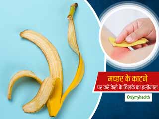 मच्‍छर के काटने पर राहत पाने में मददगार है इन 3 तरीकों से केले के छिलके का इस्‍तेमाल
