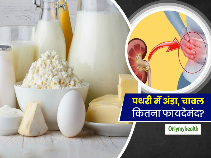 गुर्दे की पथरी में अंडा, दूध, दही और चावल खाना फायदेमंद है? एक्सपर्ट से जानें किन चीजों का सेवन है हानिकारक