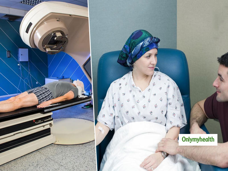 Radiotherapy Vs Chemotherapy: Let's Understand The Difference And Side Effects
