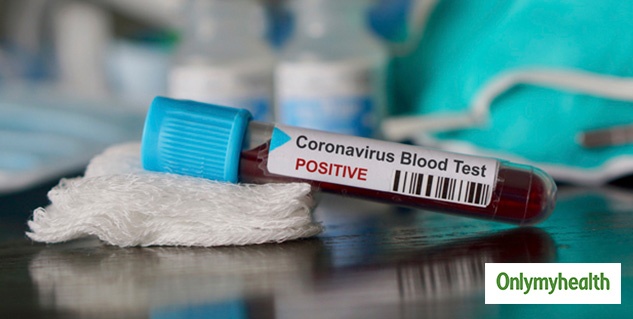 corona virus