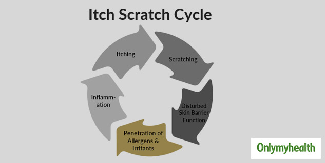 Excessive Itching Around The Breasts Is An Initial Sign Of 'Nipple  Dermatitis