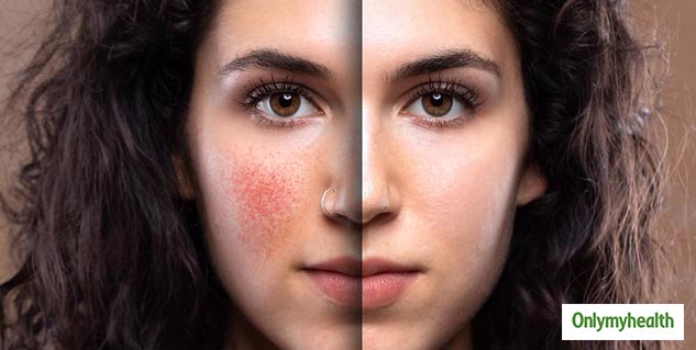 insidehowtogetridofredness