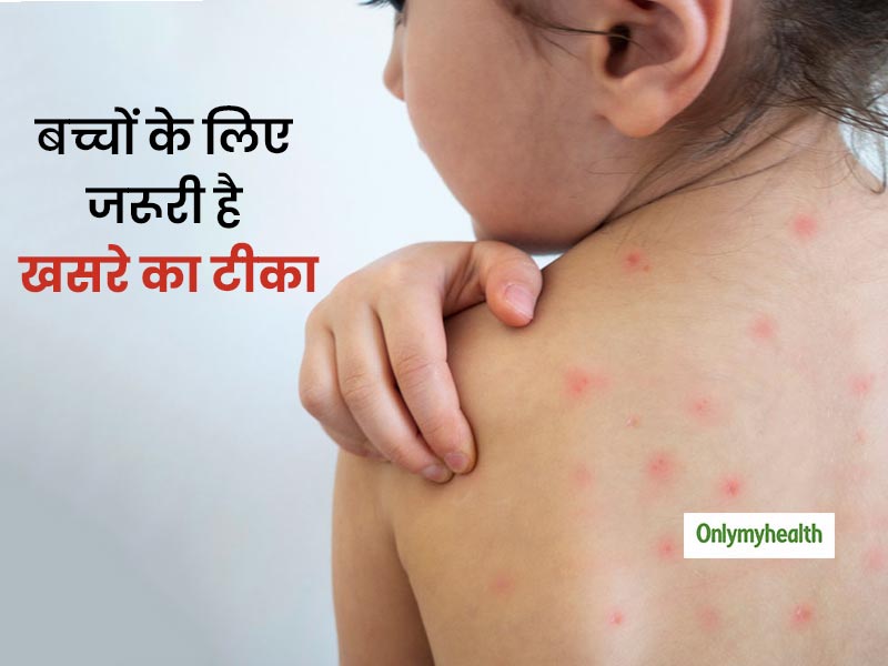 Measles Immunization Day 2020: बच्चों के लिए बेहद जरूरी है खसरे का टीका लगवाना, जानें क्यों खतरनाक है ये बीमार