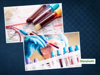 ब्लड टेस्ट करवाने से पहले इन बातों का जरूर रखें ख्याल 