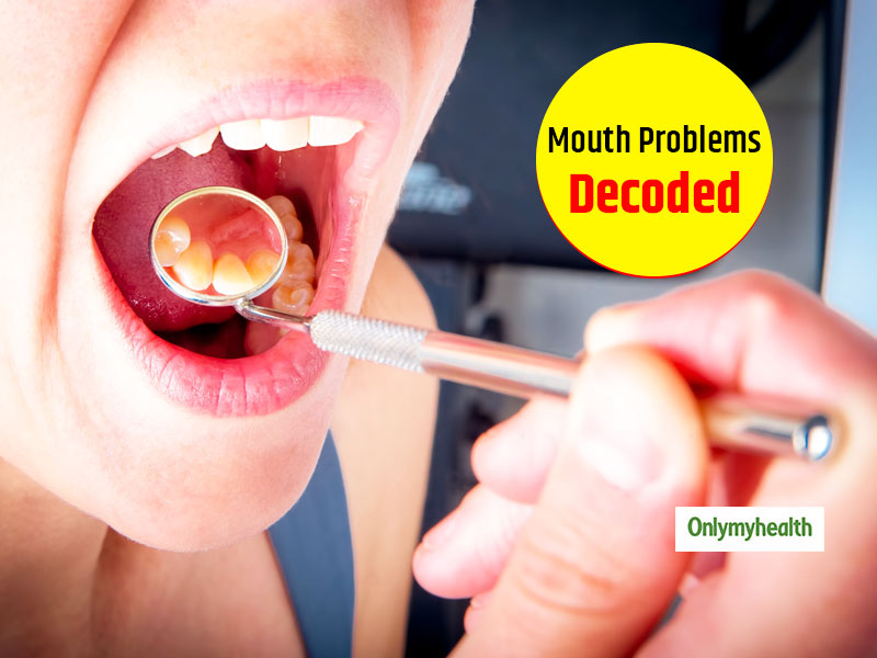 Oral Health Awareness Know About The Common Mouth Problems And Prevention Tips OnlyMyHealth