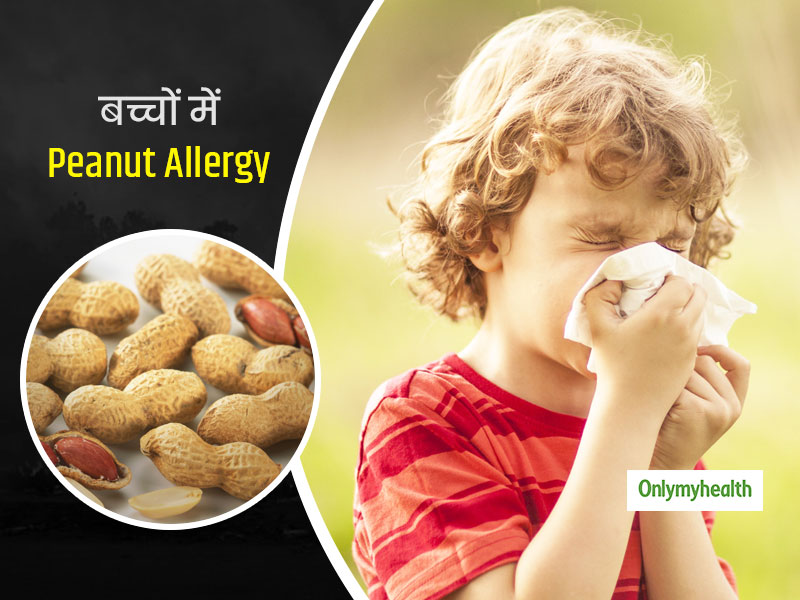 मूंगफली खाते ही आपके बच्चों को भी होती हैं ये 7 परेशानियां? हो सकते हैं Peanut Allergy के लक्षण
