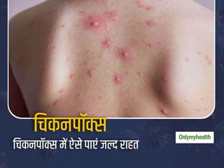 जानें क्या है चिकनपॉक्स के प्रमुख लक्षण और इलाज के आसान तरीके