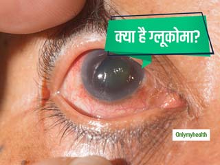 आंखों की रोशनी कम होना हो सकता है ग्लूकोमा का संकेत, जानें इसके लक्षण और बचाव 