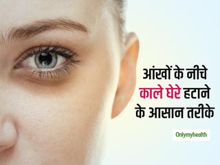 आंखों के नीचे के काले घेरों (Dark Circles) को दूर करने के 4 सबसे सुरक्षित और प्राकतिक उपाय जानें
