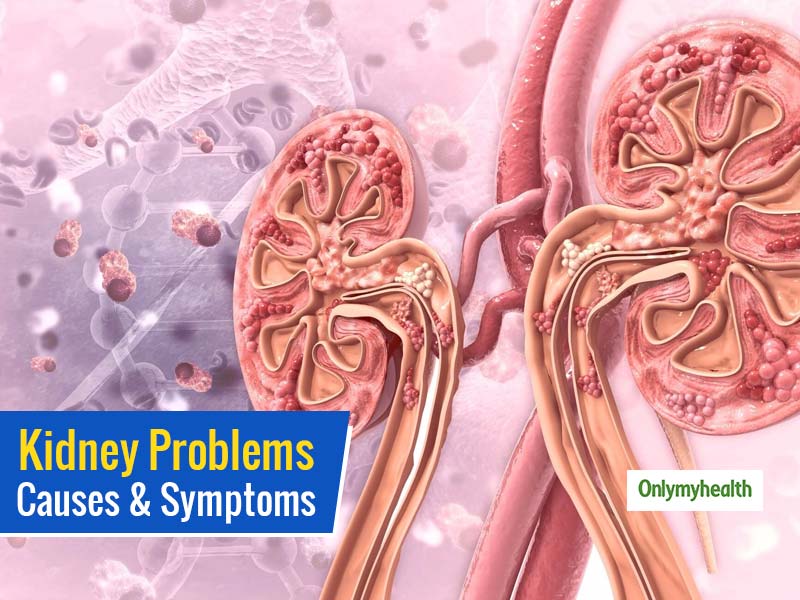 Kidney Problems Causes And Symptoms: Importance Of Prevention And Timely Treatment
