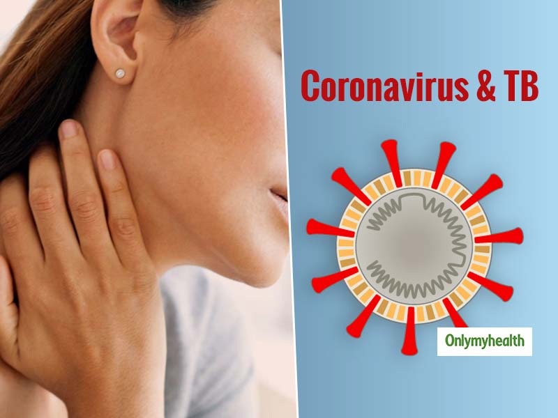 TB And Coronavirus: Extra Care For TB Patients During COVID-19 Outbreak
